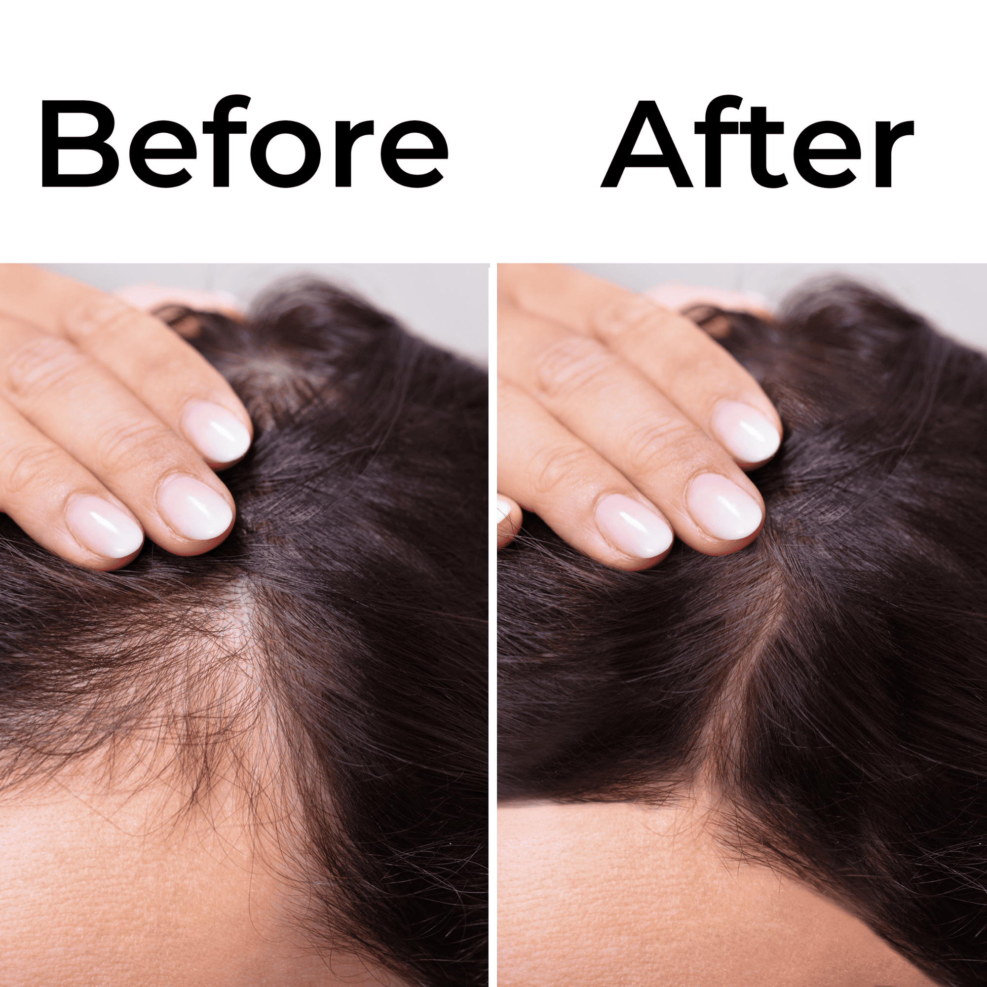 The Roots Naturelle | Batana Oil Drops Raw and Pure Hair Solution., photo 5 of 5