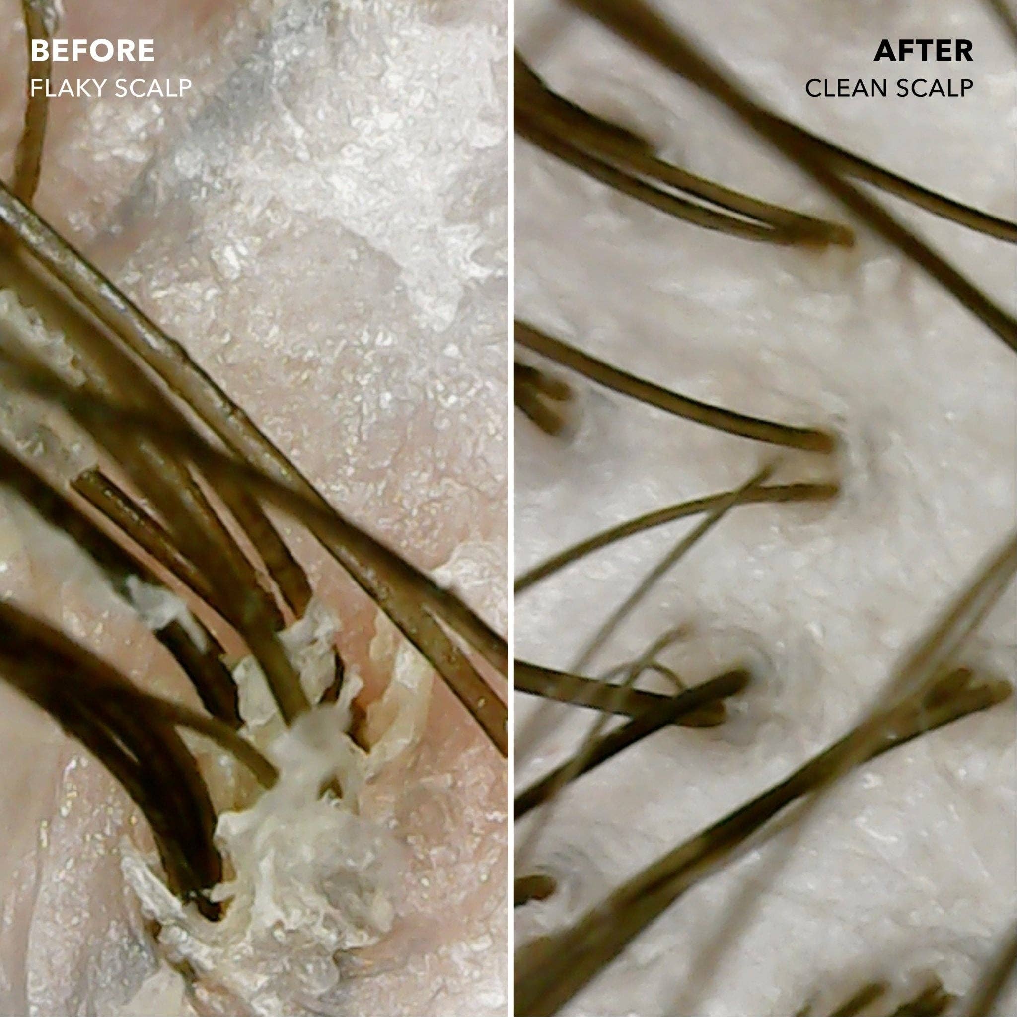 SUNDAY II SUNDAY | Signature Scalp Balancing Shampoo, photo 6 of 8