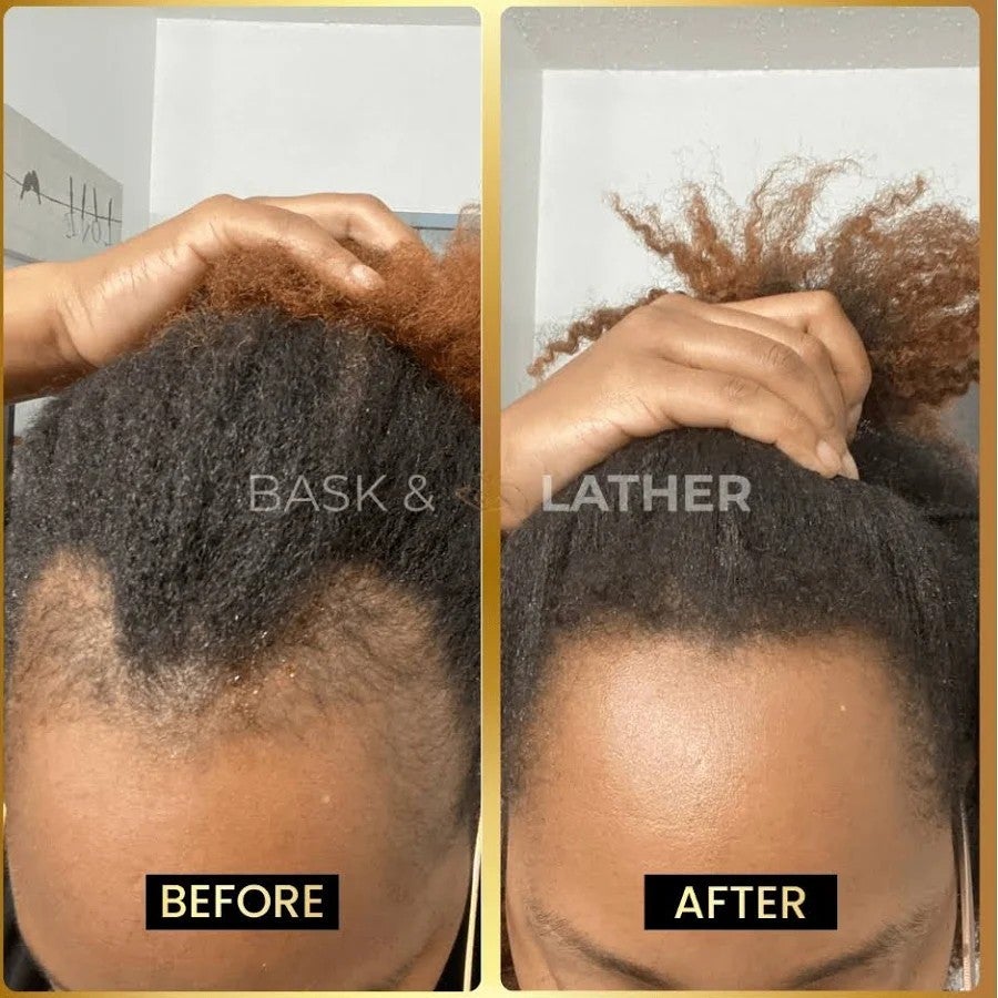 BASK & LATHER | Jumbo Scalp Stimulator - Hair Growth Oil [2 months supply], photo 2 of 2